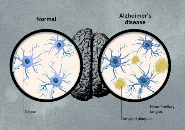 clinical-trial-results-MMpVzLnWz7.jpg